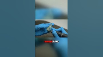 Mastering Post Processing for Surgical Guides! #dentallab #surgicalguide #digitaldentistry #dental