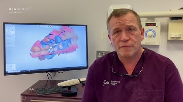 Dr. Ian Buckle - Making the most of an intra-oral scanner: every minute, every day #Dentology2021