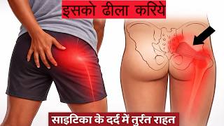साइटिका ठीक करने के लिए इस मांसपेशी को ढीला करें Release This Muscle to Fix Sciatica Pain