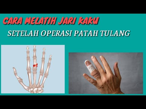 Video: Cara Mengenali Tingkah Laku Stalking Negatif (dengan Gambar)