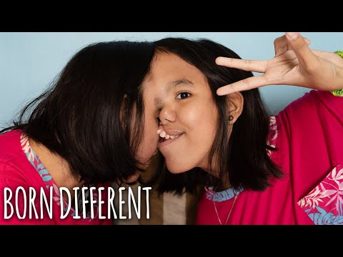 Video: In The Philippines, A Girl Was Born With Two Heads And Three Legs - Alternative View