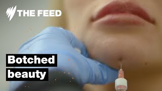 Botched Beauty Horror Scenes From Australias Backyard Beauty Clinics Sbs The Feed