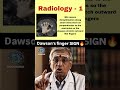 Dawson’s Fingers| Best app for NEET PG Preparation |Dopamine|
