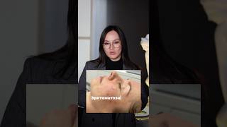 История одного приема или почему важна консультация врача косметолога! #акне #клиникакосметологии