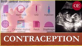 On Contraception: The Orthodox Christian Stance