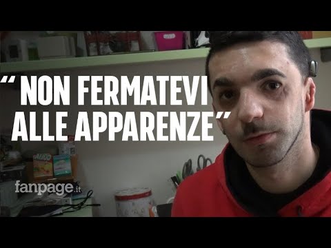 Raffaele, nato con la sindrome di Treacher Collins: "Mi chiamano malformato di merda, ma io sorrido"