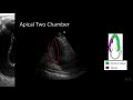 Point-of-Care Echo: Regional Wall Motion Abnormalities