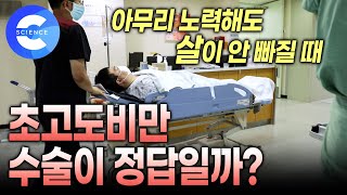 덜 먹고 운동해도 살이 안 빠질 수 있을까? 수술해야하는 비만 체질 | 고도비만! 나의 잘못이 아닐 수 있다 | 비만유전자