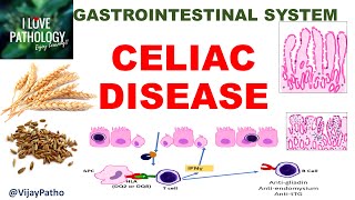 Celiac disease: Etiopathogenesis, Morphology & Clinical features #GIPath #ilovepathology
