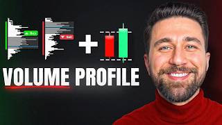 The Only VOLUME PROFILE Trading Strategy You‘ll EVER Need! (LIVE Trade Examples)