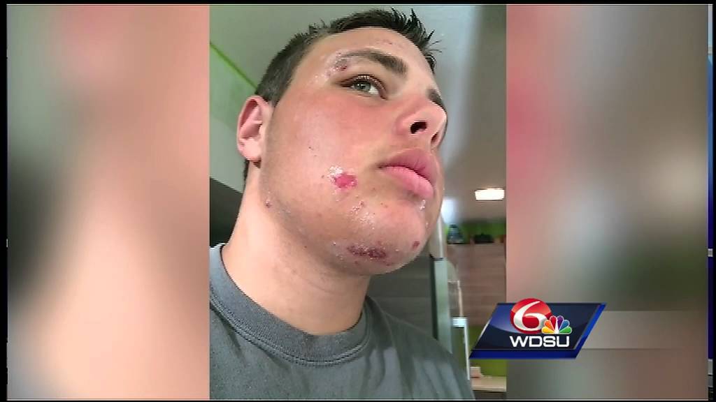 Weekend house call: staph Infections