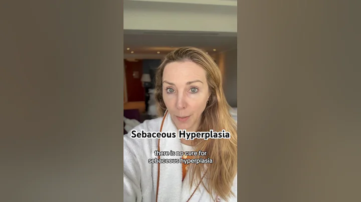Derm explains how to deal with sebaceous hyperplasia