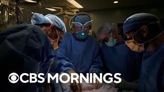 Exclusive interview with lead scientist behind successful kidney transplant