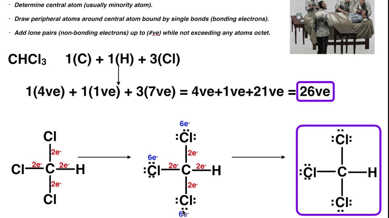 General Chemistry Lewis Structures Example 3 