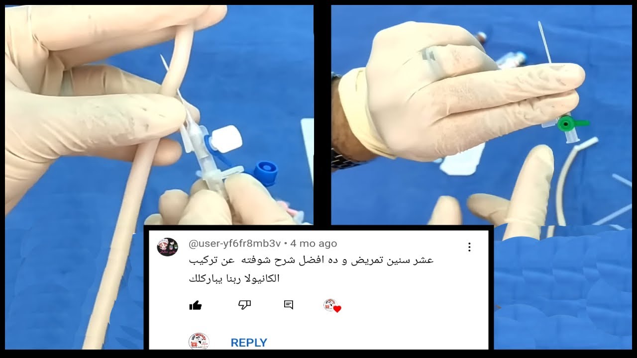 أسهل طريقة لتتعلم كيفية تركيب الكانيولا الوريدية - تركيب الكانيولا باحتراف cannula insertion
