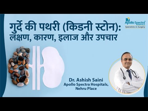 वीडियो: क्या मैंने अपनी किडनी स्टोन पास कर लिया है?