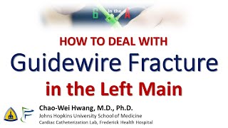 How to Deal With Guidewire Fracture in the Left Main