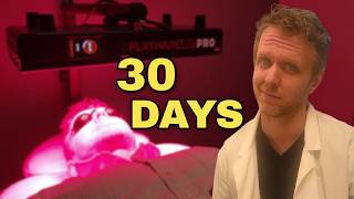 Does Red Light Therapy Actually Work for Dry Eye? I Tested It for 30 Days