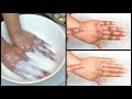 LIGHTEN DARK KNUCKLES |HOW TO GET 5 TO 10 YEARS YOUNGER LOOKING HANDS |Khichi Beauty