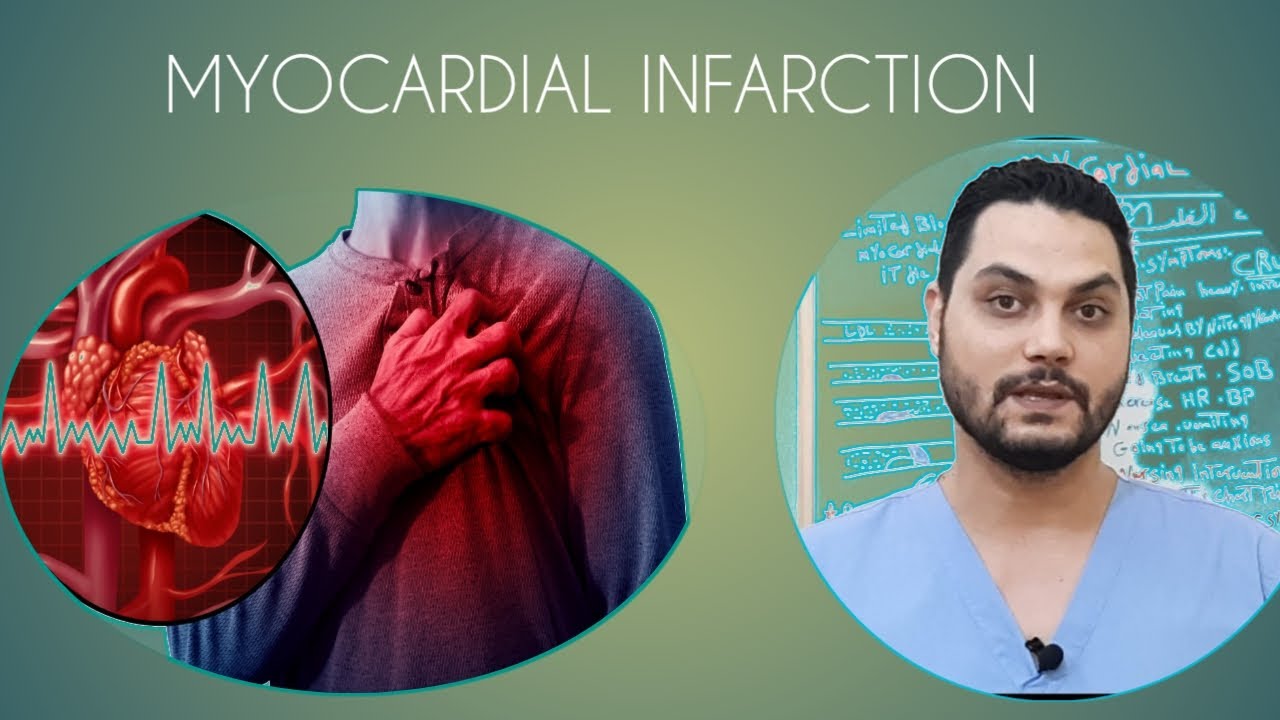 جلطة القلب,الأسعافات الأولية لشخص مصاب بجلطة القلب, مذيب الجلطة MYOCARDIAL INFARCTION #NURSE_NOTE_1