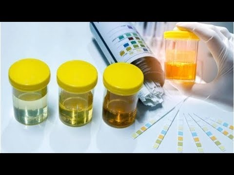 Video: Cómo reducir las proteínas en la orina: tratamientos aprobados por médicos