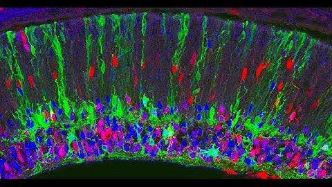 Markus Meister: 2011 Allen Institute for Brain Science Symposium