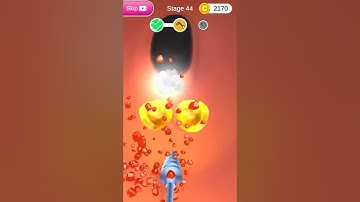 ❗Earwax Clinic❗ All Levels Mobile Game Walkthrough Trailers Update Gameplay iOS,Android