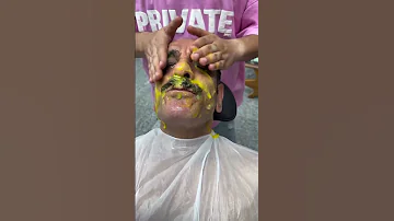 اقا مضفر رفته پاکسازی پوست 