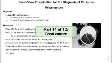 Part 11: Fecal or stool culture for the diagnosis of parasitism