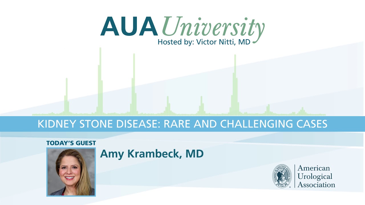 AUAU Podcast: Kidney Stone Disease: Rare and Challenging Cases