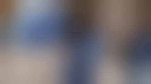 Removel of cataract with SEVERE PXF and PHACODONESIS