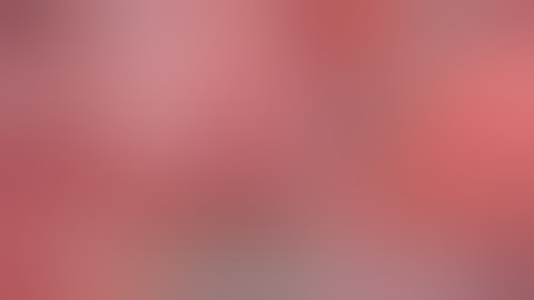 Critical View of Safety (CVS)aparoscopic cholecystectomy