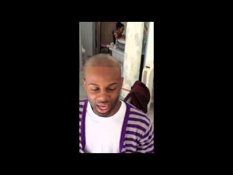 Video thumbnail: Hair Transplants Alternatives | Hair Loss Solutions | Hairsimulation for Hair Loss Update Mr. AJ