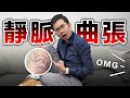 靜脈曲張嚴重恐致命! 每天抬腿竟然沒用!? feat. 靜脈大王 張學倫醫師