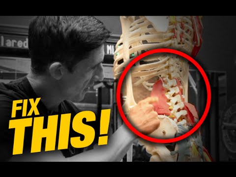 What Scoliosis Icd X