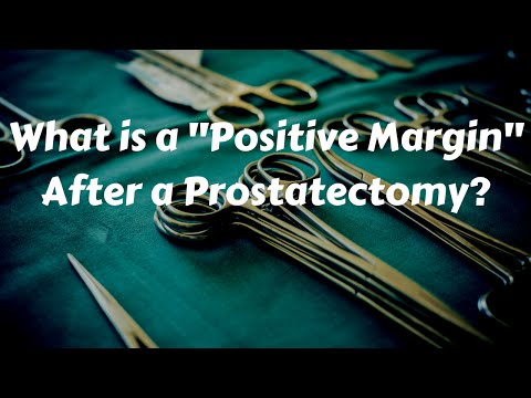 प्रोस्टेटक्टोमी के बाद सकारात्मक मार्जिन क्या है?