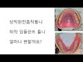 [부산임플란트틀니] 상악완전흡착틀니 하악임플란트틀니 얼마나 편할까요? (광안리 뉴욕치과 6-19-5, 6-21-7)