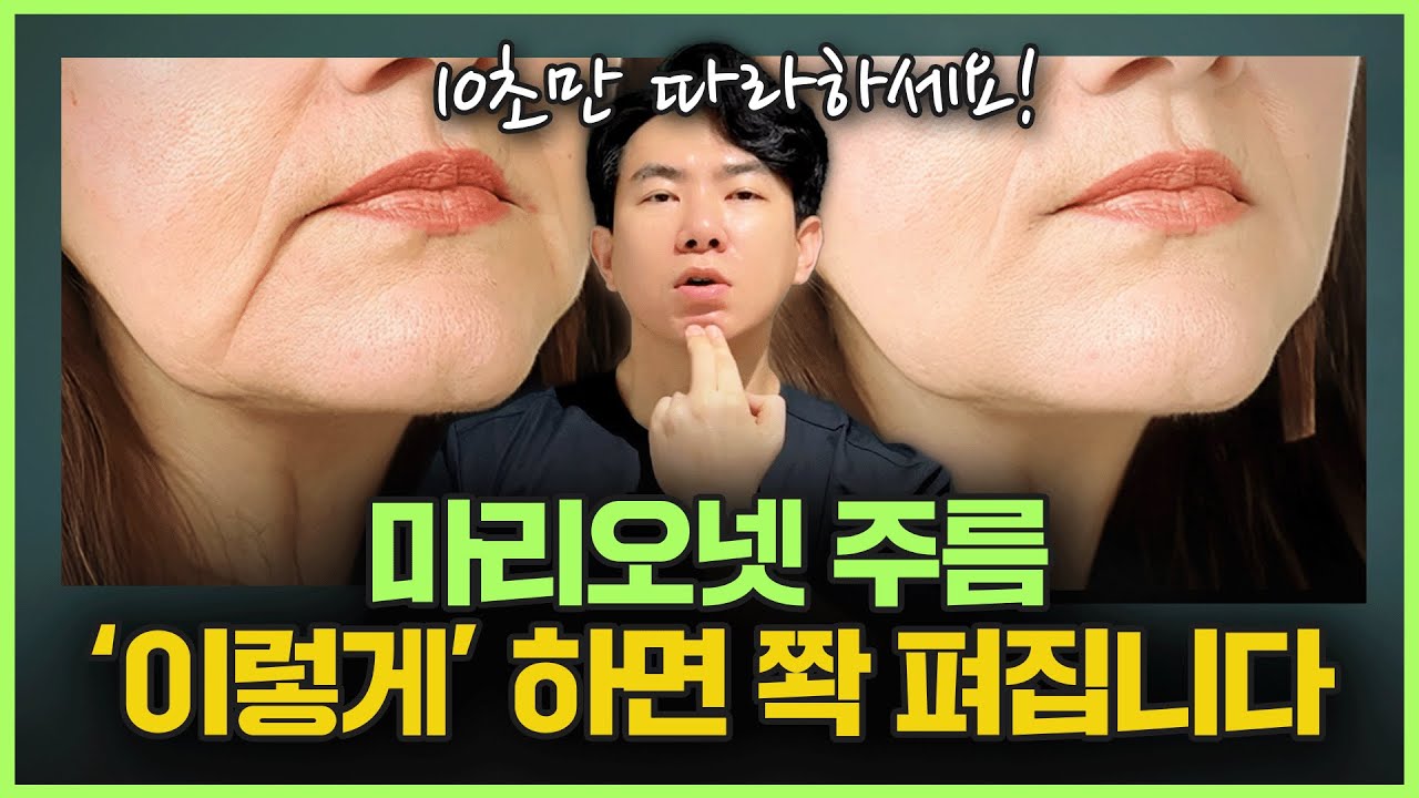 수술없이 마리오네트 주름, 입가주름 없애는 방법! | 10년차 의사가 알려주는 10초 운동법! 축 늘어진 불독살, 심술보 관리 총정리