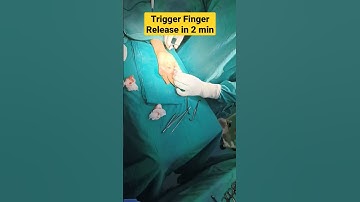 Trigger Finger Release in 2 Minute | #triggerfinger #ganglion #handsurgery #handsurgeon #orthopedics