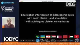 How to Diagnosis and Treatment of Cyst || Dr. mohamed Al. Qalla