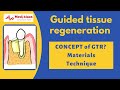 Guided Tissue Regeneration