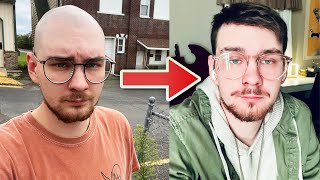 Andrew's Hair System Transformation After Balding, Shaving His Head, SMP, and Using Keratin Fibers