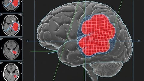 Brain Tumor Segmentation