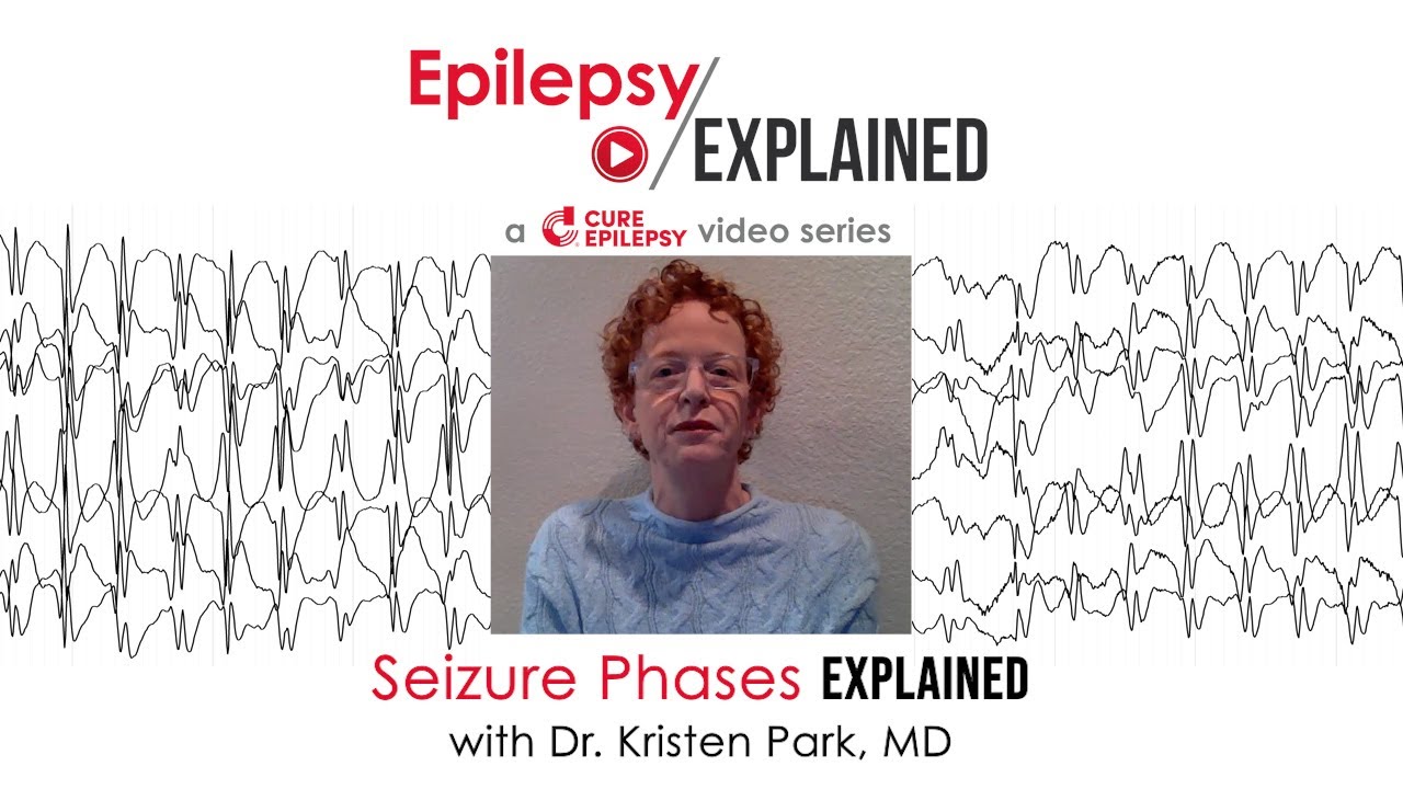 Seizure Phases Explained: What Happens Before, During, and After a Seizure