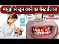 मसूड़ों से खून आने का बेस्ट ईलाज // bleeding gums // Gingivitis treatment // Periodontal disease