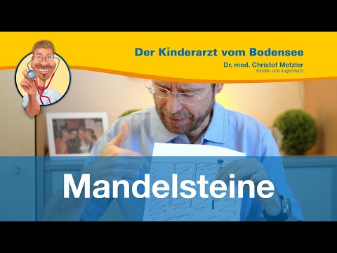 Video: 4 Möglichkeiten, Tonsillensteine (Tonsillolithen) zu entfernen