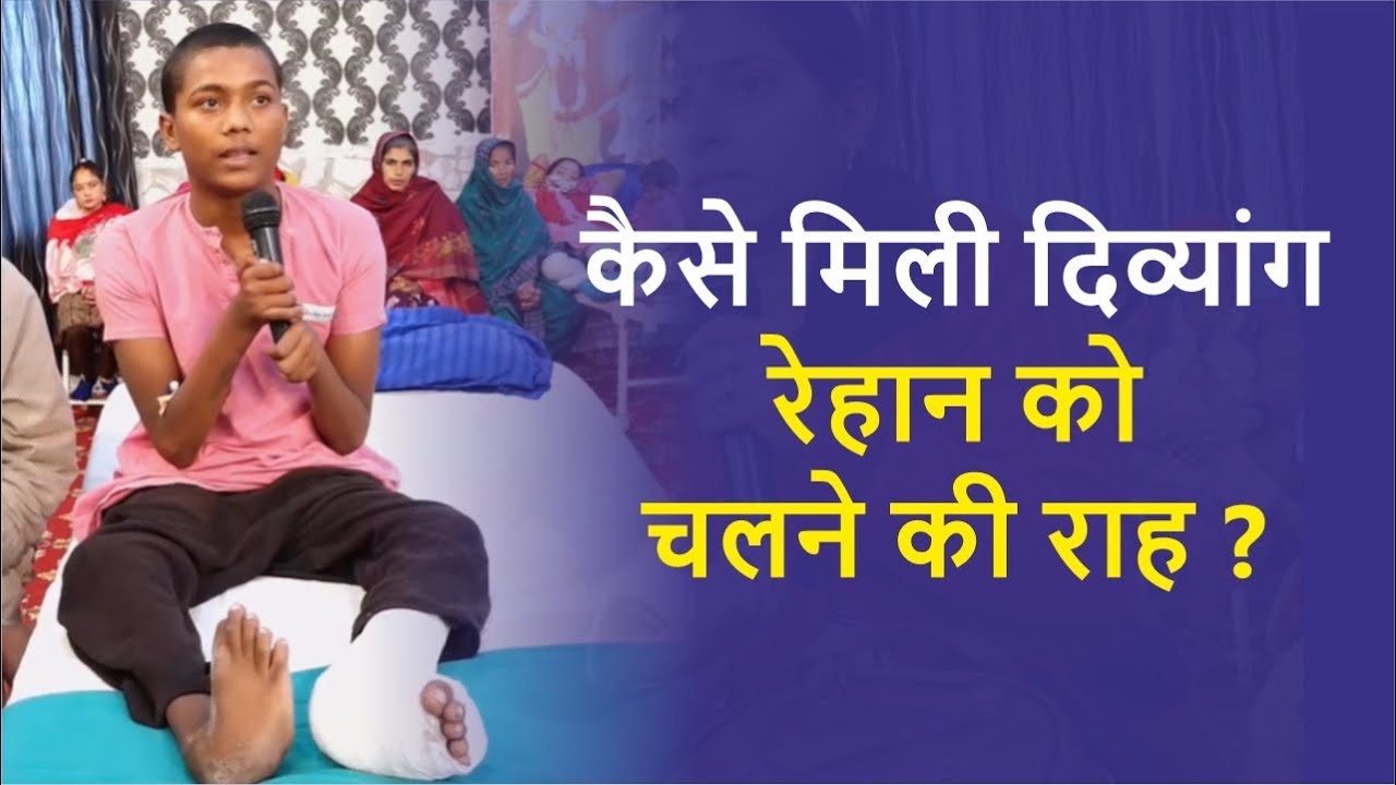 निःशुल्क इलाज के बाद रेहान जल्द ही अपने पैरों पर खड़ा हो पाएगा | Club Foot | Narayan Seva Sansthan |