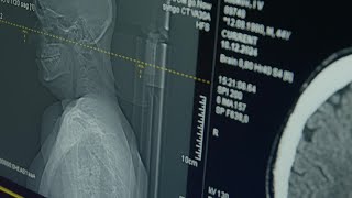 Deep brain stimulation trial explores new treatment for depression