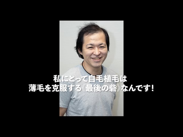 自毛植毛 体験者】自分の自信を取り戻す。 親和クリニック【 新宿