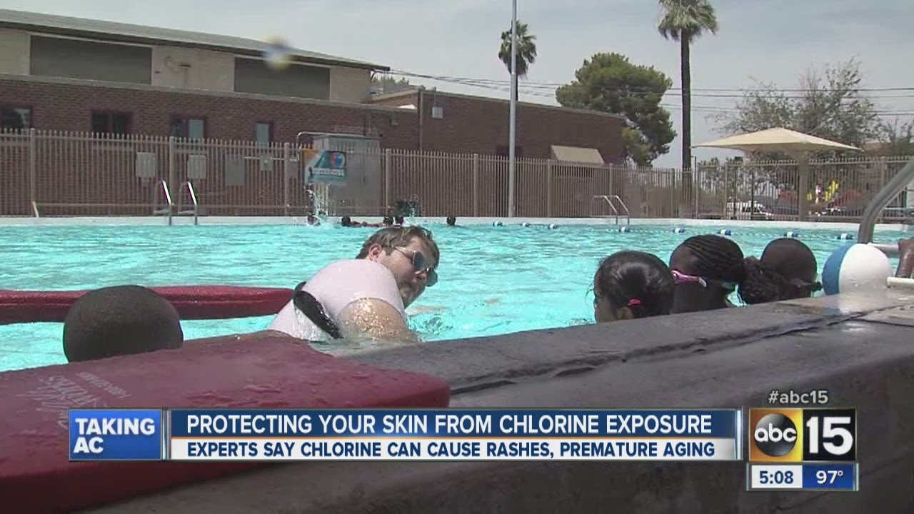 Chlorine Rash Symptoms, Treatment, Prevention atelieryuwa.ciao.jp